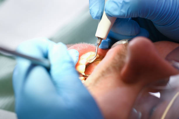 Best Emergency Treatment for Oral Infections in Mullica Hill, NJ